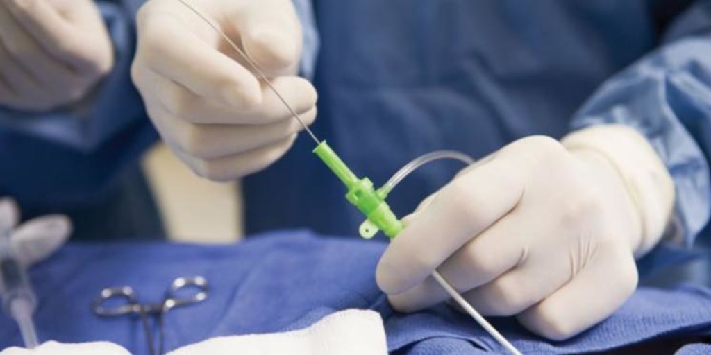 DuPont buys medical tubing extruder Spectrum Plastics Group for $1.75B - Vimarsana News