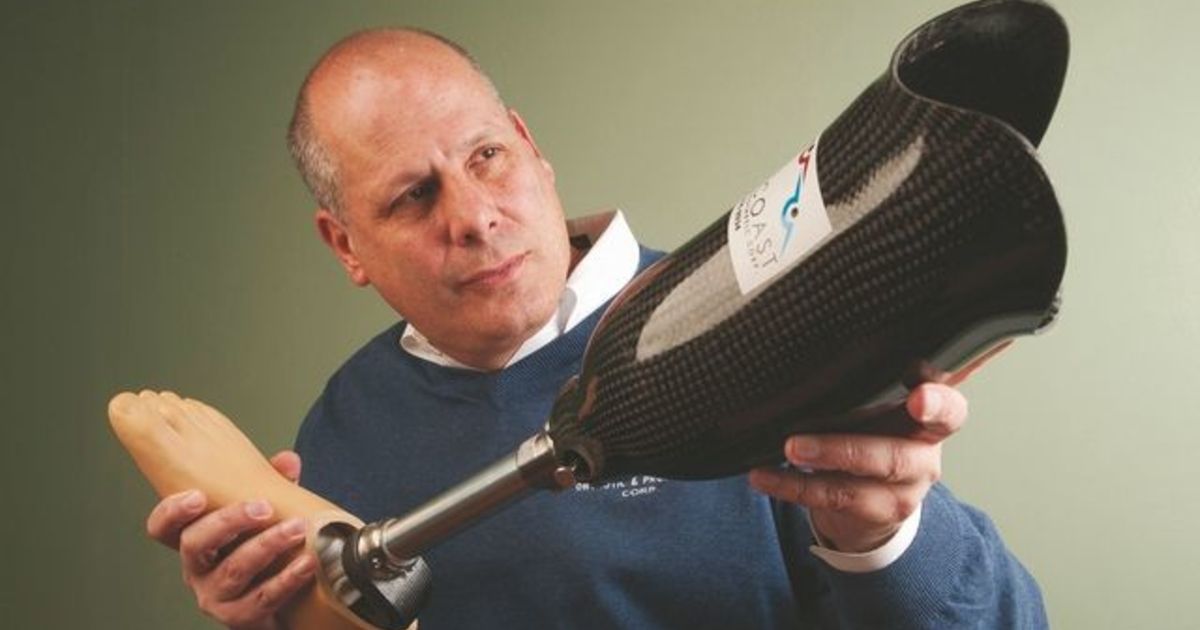 Prostheticsmakersseenewtechnologyaddingtoastrongmarket